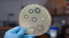 בדיקת חיידקים עם אנטיביוטיקה (אילוסטרציה)