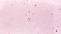 דלקת קרום המוח: צילום מיקרוסקופי של חיידקי Neisseria meningitidis (מקור: ויקיפדיה)